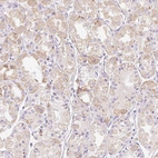 Immunohistochemical staining of human stomach shows moderate cytoplasmic positivity in glandular cells.