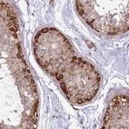 Immunohistochemical staining of human testis shows moderate to strong granular cytoplasmic positivity in seminiferous ducts.