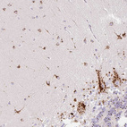 Immunohistochemical staining of human cerebellum shows strong granular pattern cytoplasmic positivity in Purkinje cells.