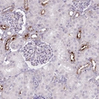 Immunohistochemical staining of human kidney shows strong granular cytoplasmic positivity in cells in tubules.