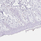 Immunohistochemical staining of human skin shows negative cytoplasmic positivity in fibroblasts as expected.