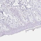 Immunohistochemical staining of human skin shows negative cytoplasmic positivity in fibroblasts as expected.