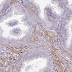 Immunohistochemical staining of human prostate shows no positivity in glandular cells as expected.
