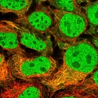 Immunofluorescent staining of human cell line CACO-2 shows localization to nucleoplasm & cytosol.