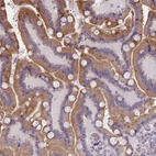 Immunohistochemical staining of human duodenum shows moderate cytoplasmic positivity in glandular cells.
