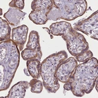 Immunohistochemical staining of human placenta shows moderate cytoplasmic positivity in glandular cells.
