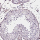 Immunohistochemical staining of human testis shows no positivity in cells in seminiferous ducts as expected.