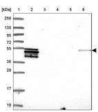 Lane 1: Marker [kDa] 250, 130, 95, 72, 55, 36, 28, 17, 10_br/_Lane 2: Human cell line RT-4_br/_Lane 3: Human cell line U-251MG sp_br/_Lane 4: Human plasma (IgG/HSA depleted)_br/_Lane 5: Human liver tissue_br/_Lane 6: Human tonsil tissue