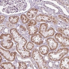 Immunohistochemical staining of human kidney shows moderate cytoplasmic positivity in cells in tubules.