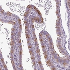 Immunohistochemical staining of human fallopian tube shows moderate cytoplasmic positivity in glandular cells.