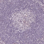 Immunohistochemical staining of human lymph node shows very weak positivity in lymphoid cells.