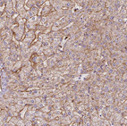 Anti-APOC1 Antibody