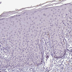 Immunohistochemical staining of human skin shows very weak granular cytoplasmic positivity in squamous epithelial cells.
