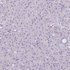 Immunohistochemical staining of human pancreas shows very weak granular cytoplasmic positivity in exocrine glandular cells.