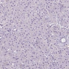 Immunohistochemical staining of human pancreas shows very weak granular cytoplasmic positivity in exocrine glandular cells.