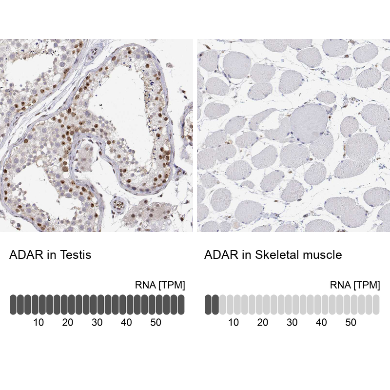Anti-ADAR Antibody