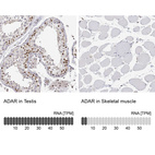 Anti-ADAR Antibody