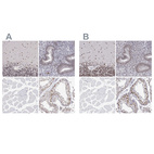 Anti-ADAR Antibody