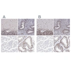 Immunohistochemical staining of human cerebellum, endometrium, skeletal muscle and testis using Anti-ADAR antibody HPA051519 (A) shows similar protein distribution across tissues to independent antibody HPA003890 (B).