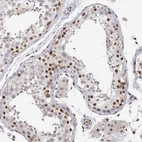 Immunohistochemical staining of human testis shows moderate to strong nuclear positivity in a subset of cells in seminiferous ducts.