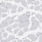 Immunohistochemical staining of human skeletal muscle shows no positivity in myocytes as expected.