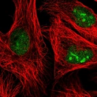 Immunofluorescent staining of human cell line U-2 OS shows localization to nucleoplasm & nucleoli.