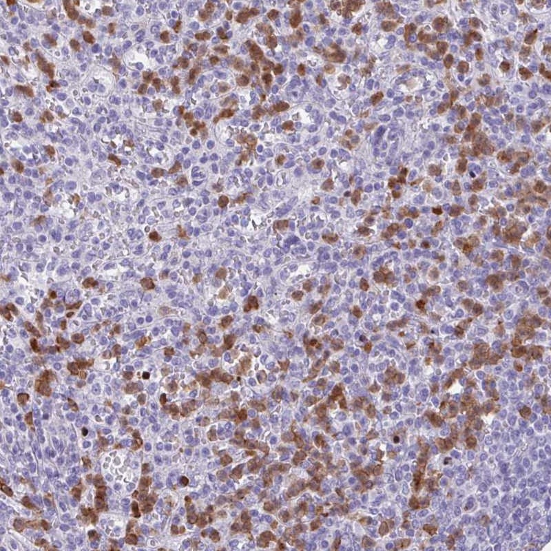 Anti-CEP120 Antibody
