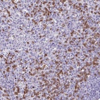 Anti-CEP120 Antibody