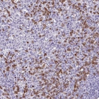 Anti-CEP120 Antibody