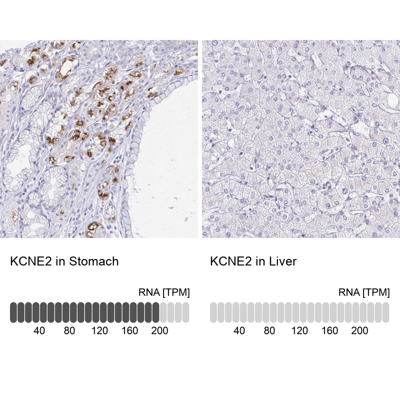 Anti-KCNE2 Antibody