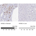 Anti-KCNE2 Antibody