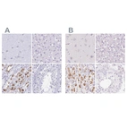 Immunohistochemical staining of human cerebral cortex, liver, stomach and testis using Anti-KCNE2 antibody HPA051553 (A) shows similar protein distribution across tissues to independent antibody HPA029706 (B).