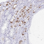 Immunohistochemical staining of human stomach shows high expression.