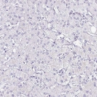 Immunohistochemical staining of human liver shows low expression as expected.