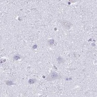 Immunohistochemical staining of human cerebral cortex using Anti-KCNE2 antibody HPA051553.