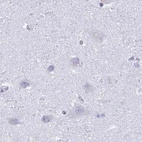 Immunohistochemical staining of human cerebral cortex using Anti-KCNE2 antibody HPA051553.