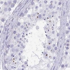Immunohistochemical staining of human testis using Anti-KCNE2 antibody HPA051553.