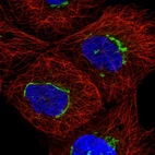 Anti-TMEM25 Antibody