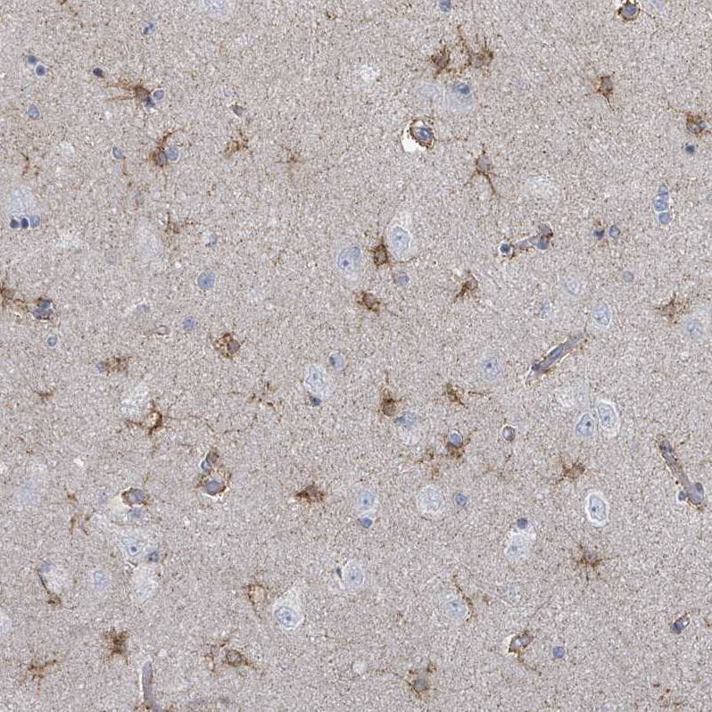 Anti-FAM210A Antibody