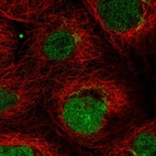 Immunofluorescent staining of human cell line A-431 shows localization to nucleoplasm & the Golgi apparatus.