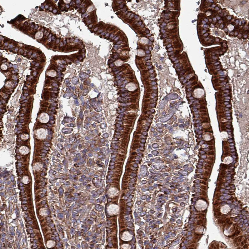 Anti-ANO10 Antibody