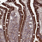 Anti-ANO10 Antibody