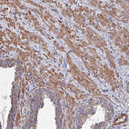 Immunohistochemical staining of human prostate shows moderate cytoplasmic positivity in smooth muscle cells.