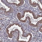 Immunohistochemical staining of human endometrium shows strong cytoplasmic positivity in glandular cells.