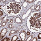 Immunohistochemical staining of human kidney shows strong cytoplasmic positivity in cells in glomeruli.