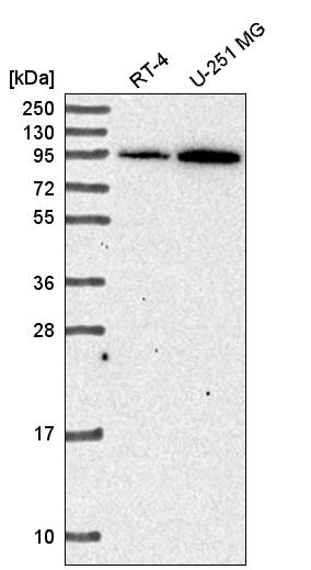 Anti-ADAM17 Antibody