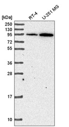 Anti-ADAM17 Antibody