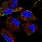 Immunofluorescent staining of human cell line U-251 MG shows localization to cytosol.