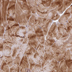 Anti-RIC1 Antibody