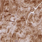 Anti-RIC1 Antibody